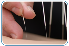 Village Acupuncture and Health Home Page